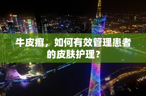 牛皮癣，如何有效管理患者的皮肤护理？