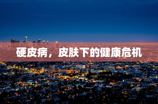 硬皮病，皮肤下的健康危机