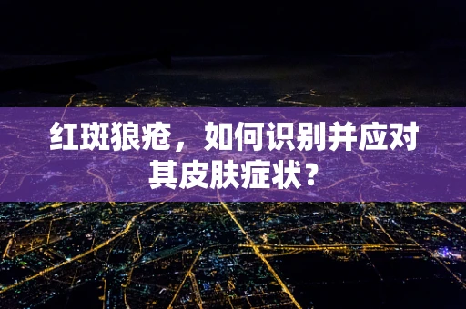 红斑狼疮，如何识别并应对其皮肤症状？