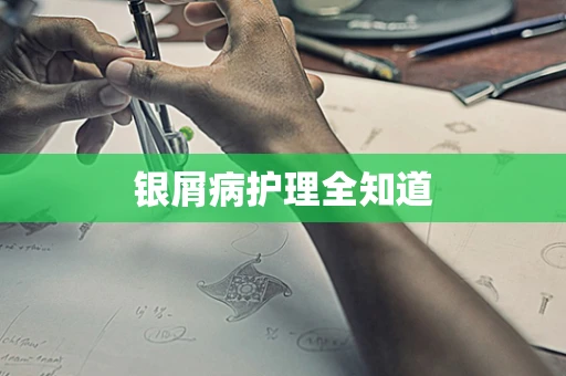 银屑病护理全知道