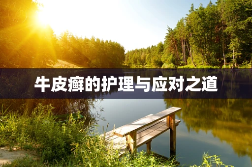 牛皮癣的护理与应对之道