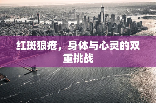 红斑狼疮，身体与心灵的双重挑战