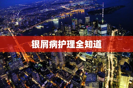 银屑病护理全知道