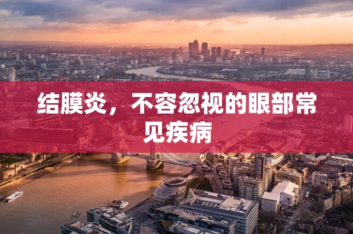结膜炎，不容忽视的眼部常见疾病