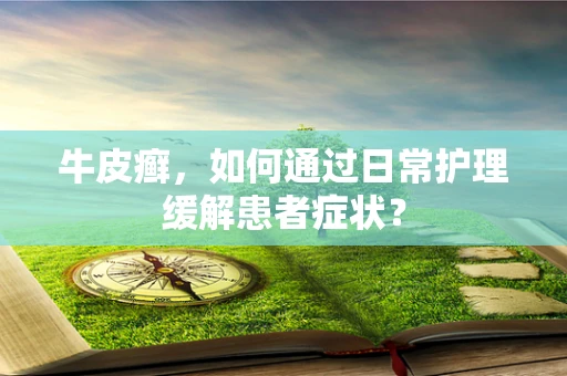 牛皮癣，如何通过日常护理缓解患者症状？